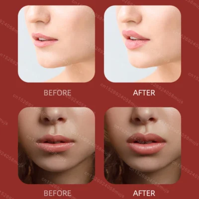 محسن شفاه كهربائي محمول ، جهاز تجميل قابل لإعادة الشحن - Image 6